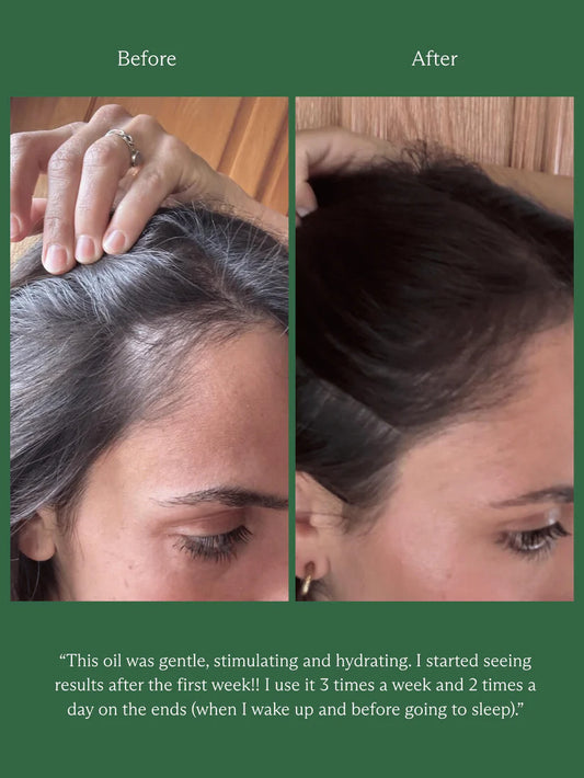 HINU HAIR GROWTH OIL | 60ML