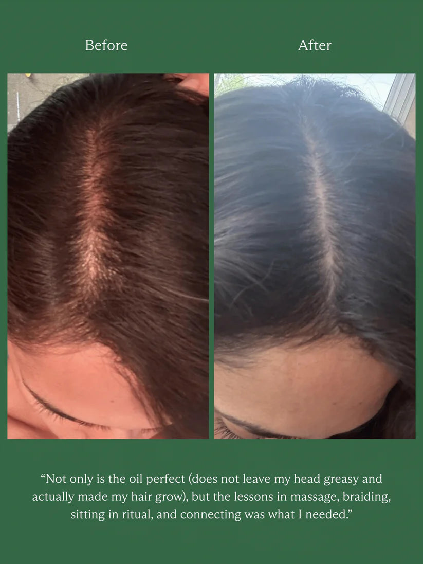 HINU HAIR GROWTH OIL | 60ML