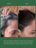 HINU HAIR GROWTH OIL | 60ML