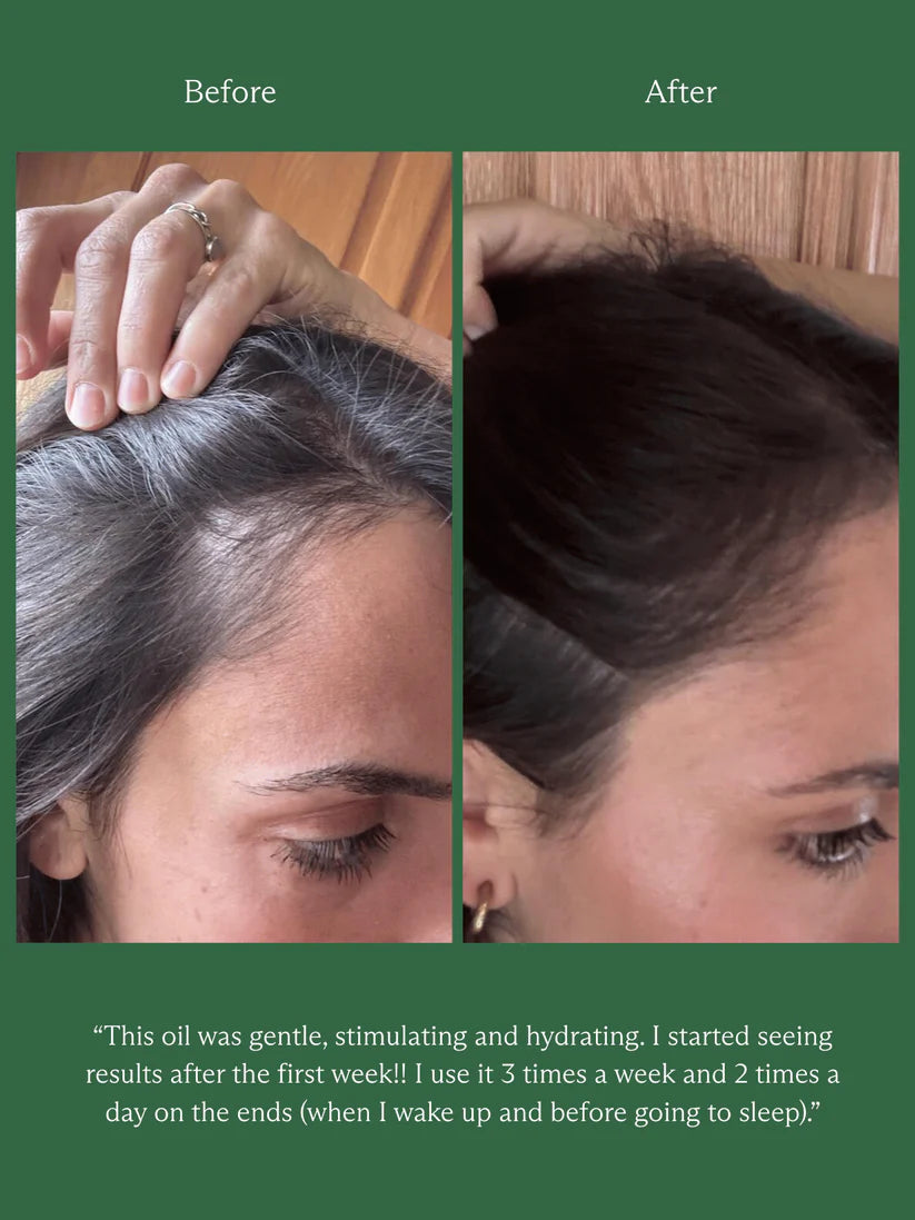 HINU HAIR GROWTH OIL | 60ML