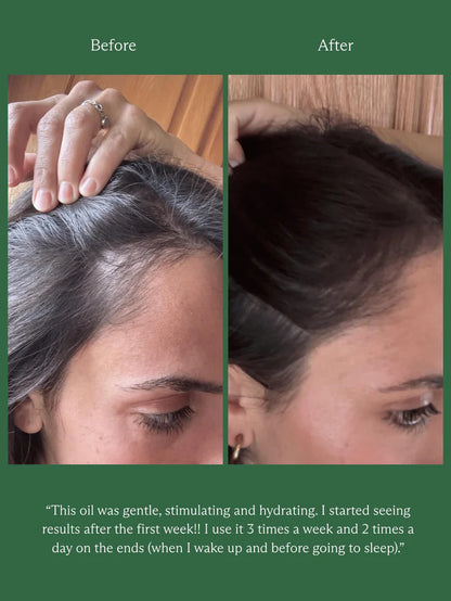HINU HAIR GROWTH OIL | 60ML