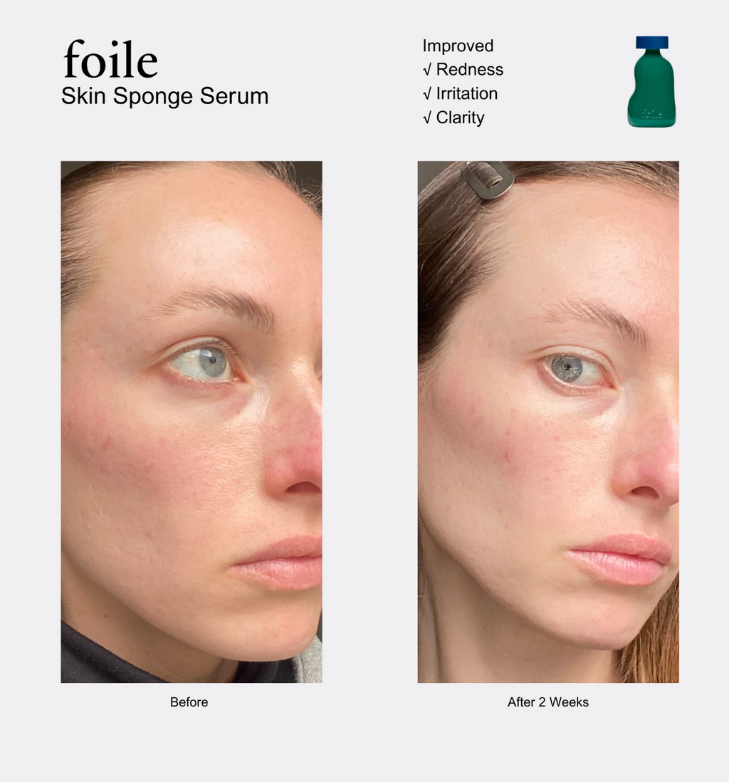 SKIN SPONGE SERUM | 50ML